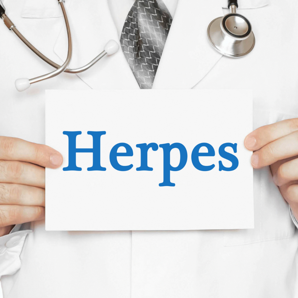 All About Herpes